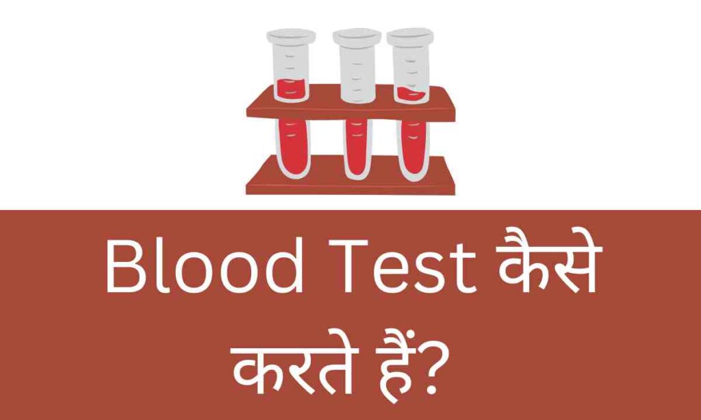 blood test kaise karte hai